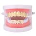 Unisex Hip Hop Braces Batch Flower Two Color 8 Braces HIP HOP Hip Hop Jewelry Gold Teeth_ipsvogv.com
