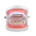 Unisex 10 Tooth Teardrop Style Hip Hop Braces Gold Braces Personality Trend New Style_ipsvogv.com
