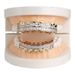 Hot Sale Hip Hop Braces Gold Plated Diamond Gold Teeth Hip Hop Grill Hip Hop Braces Bling_ipsvogv.com