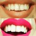 Men And Women's Jewelry Halloween Braces Diamond Gold Bar Braces Hip Hop Braces Vertical Stick Single Big Gold Tooth Diamond Braces_ipsvogv.com